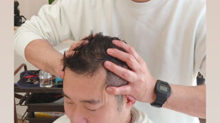 いーくに編集長のあれからと頭皮のケアが大切なことについて